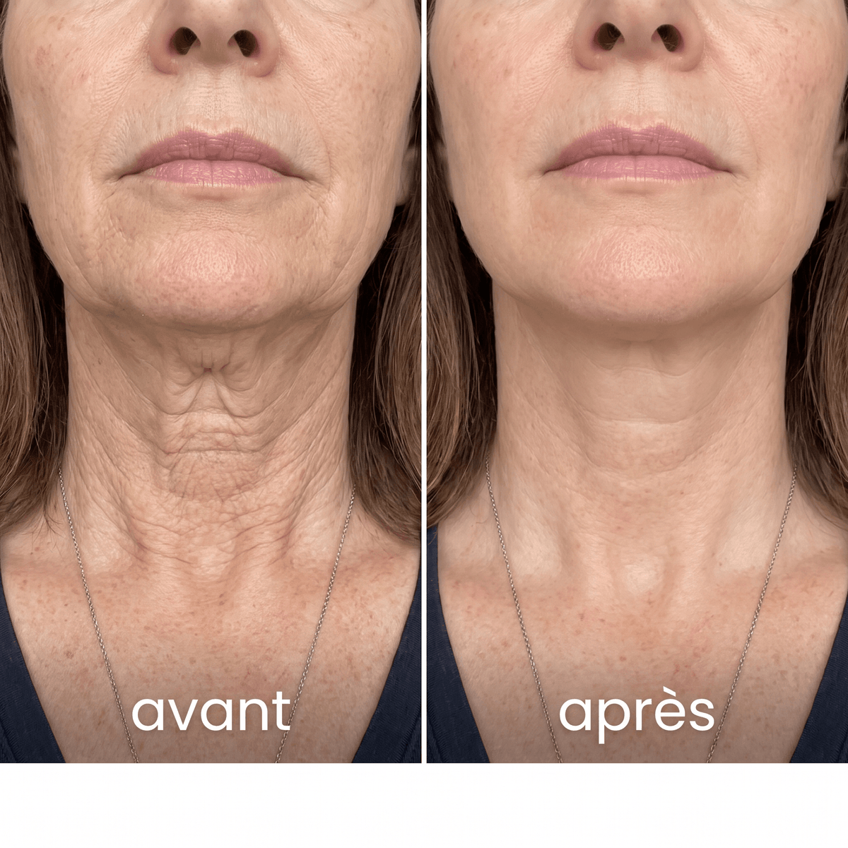 Crème Fermeté Cou & Décolleté
