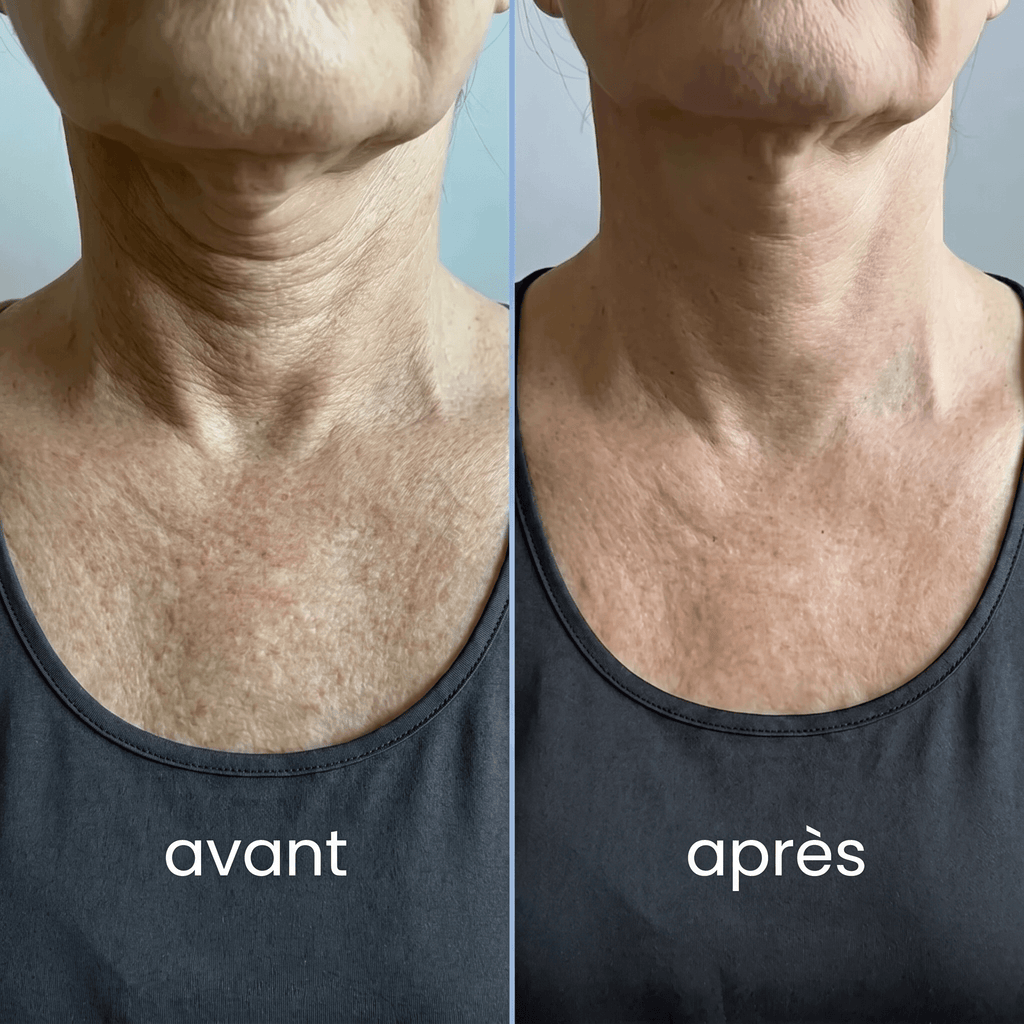 Crème Fermeté Cou & Décolleté